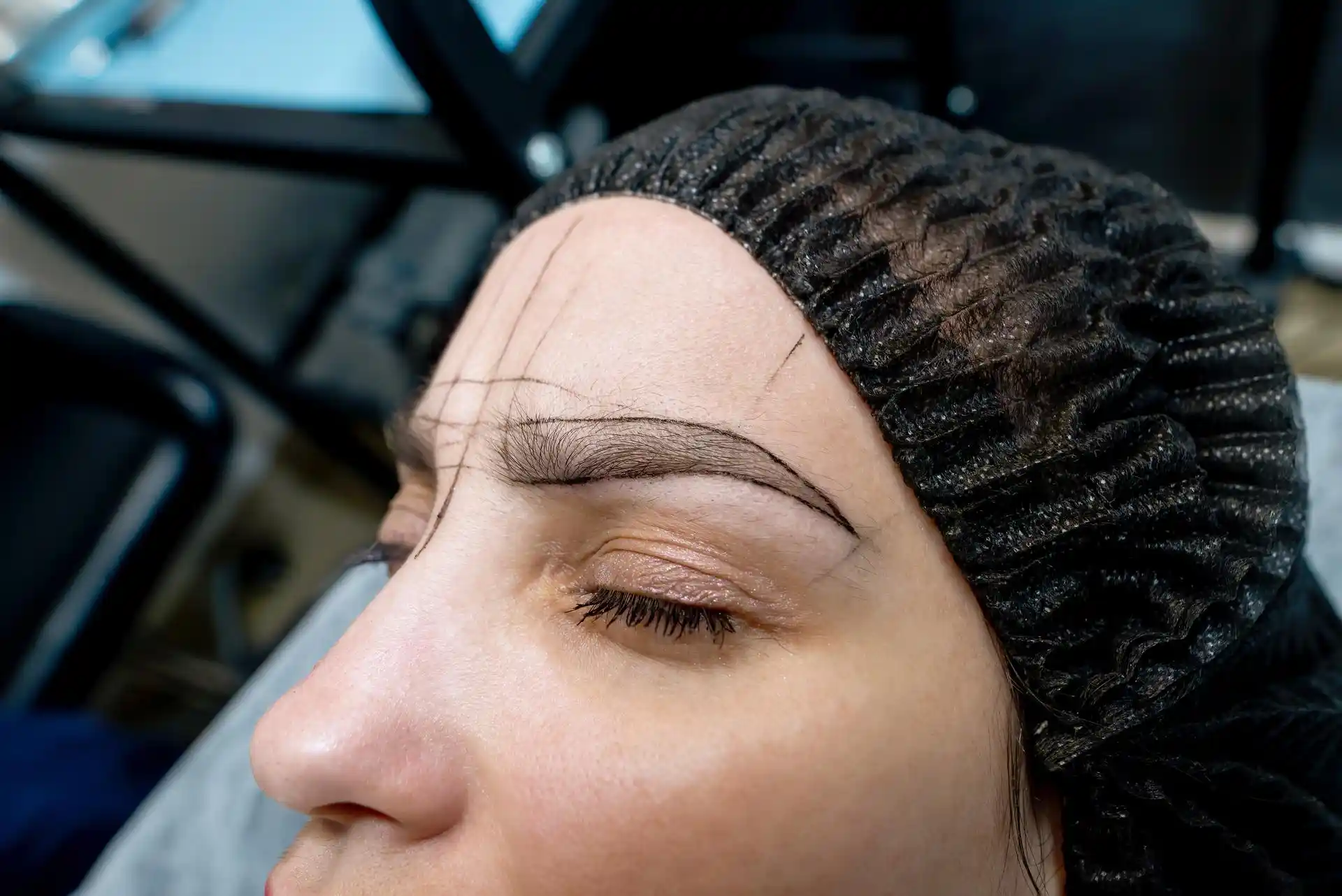 Eyebrow Reconstruction